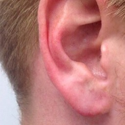 After ear lobe