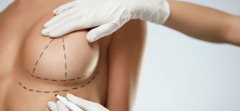 breast lift surgery